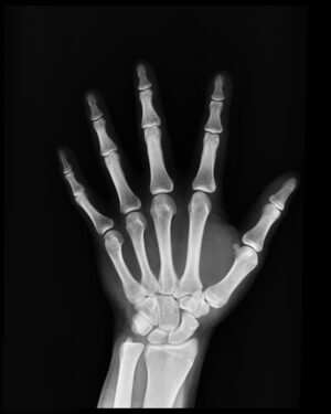 High-resolution X-ray capturing the bones of a human hand, displaying skeletal anatomy.