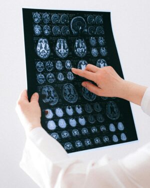 Doctor examines brain MRI scans closely for medical diagnosis in a hospital environment.